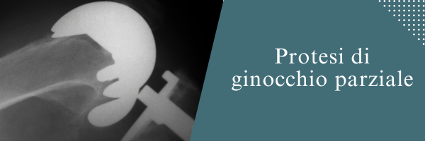Protesi di ginocchio parziale