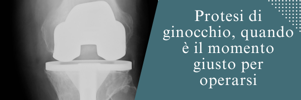 Protesi di ginocchio, quando è il momento giusto per operarsi