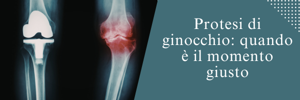 Protesi di ginocchio: quando è il momento giusto