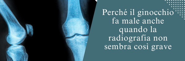 Perché il ginocchio fa male anche quando la radiografia non sembra così grave